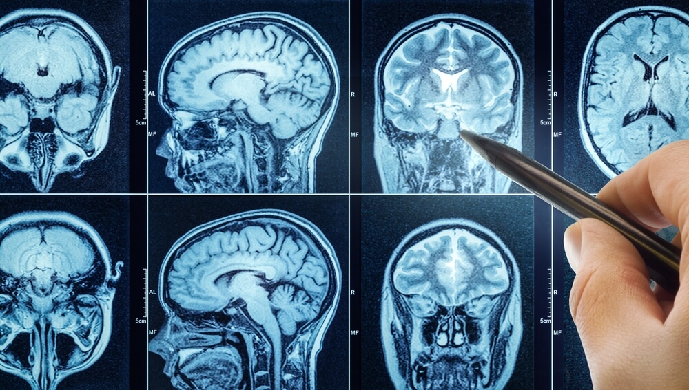 doctors examining brain injury